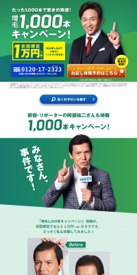 増毛1,000本キャンペーン！