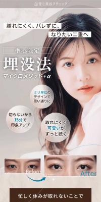 埋没法マイクロメソッド＋αのLPデザイン（エステ・脱毛・増毛・整形／ブラウン系／キレイ系）スマホ版