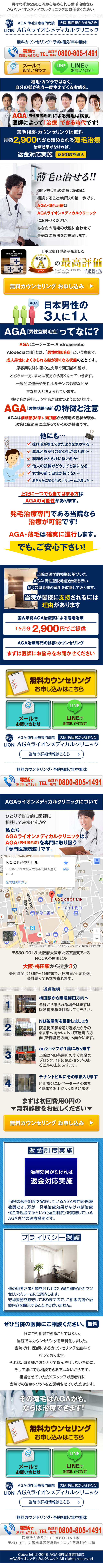 AGA治療_sp_1