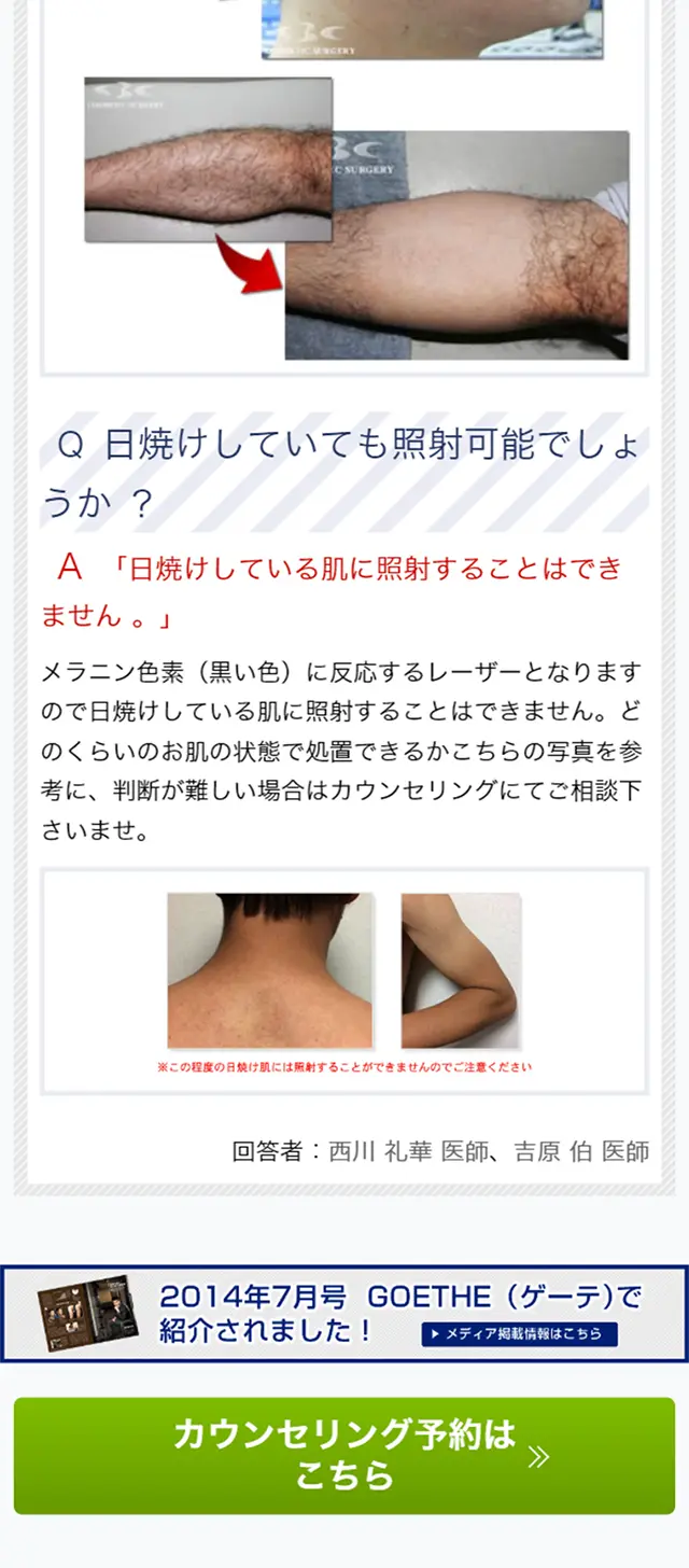 ヒゲ脱毛のLPデザイン（美容サービス／ブルー系／信頼・安心系）スマホ版