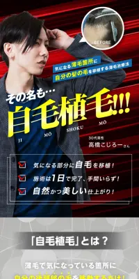 自毛植毛のLPデザイン（美容サービス／ブルー系／信頼・安心系）スマホ版