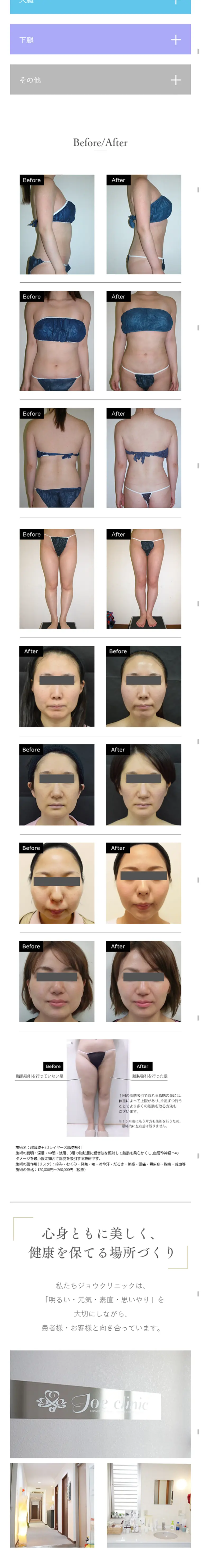 Jow Clinic Liposuction LP design (Beauty services / Shades of blue / Trust and Safety) Mobile version