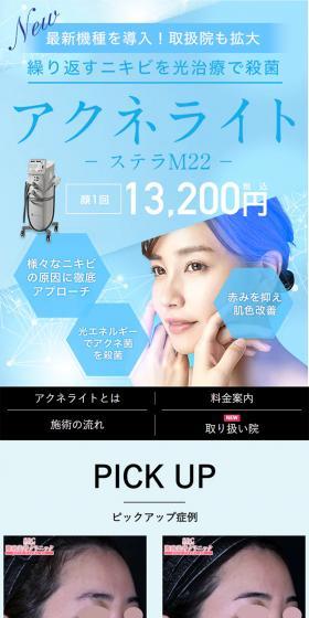 Recurring acne sterilized by light therapy: Acnelight Stellar M22