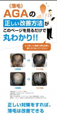 OopsHAIR