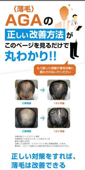 Oops HAIRのLPデザイン（エステ・脱毛・増毛・整形／ベージュ系／シンプル系）スマホ版
