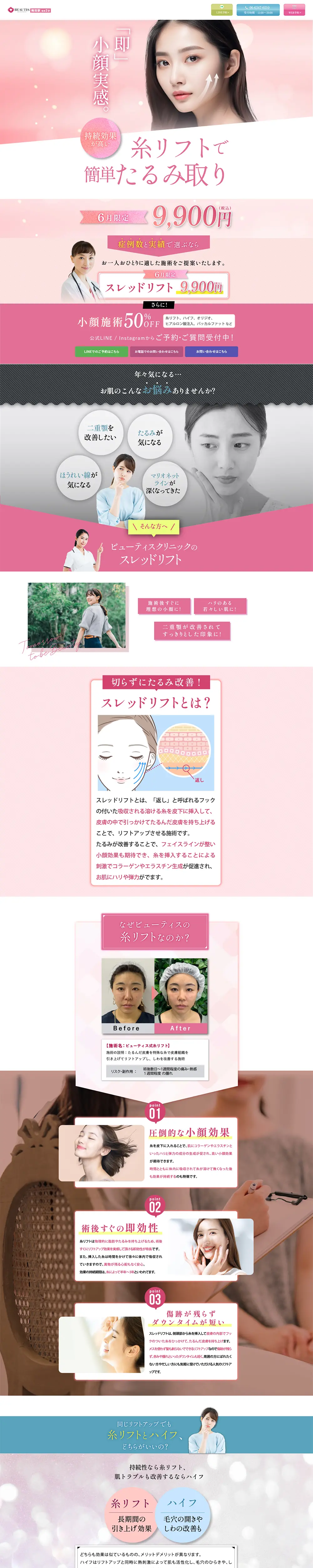 Thread Lift LP design (este / Pink shades / Refined style) PC version