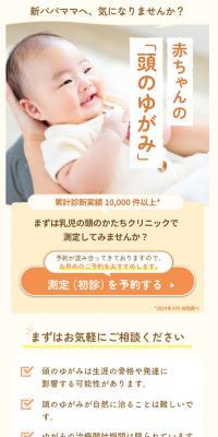 Are you concerned about your baby's head flatness?